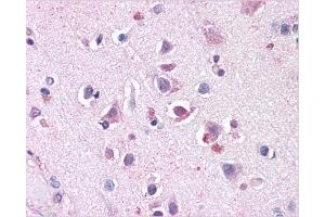 Immunohistochemical staining of Skeletal Muscle using AP31144PU-N SLC29A1 antibody (SLC29A1 antibody  (Internal Region))