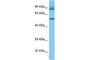 Western Blotting (WB) image for anti-Interferon-Induced Protein with Tetratricopeptide Repeats 3 (IFIT3) (N-Term) antibody (ABIN2782443)
