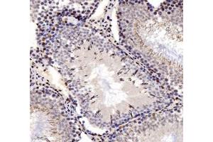 Immunohistochemistry analysis of paraffin-embedded rat testis using ADRA1B (ABIN7072974) at dilution of 1: 1200 (ADRA1B antibody)