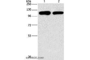 Western blot analysis of A431 and hela cell, using PIP5K1C Polyclonal Antibody at dilution of 1:500 (PIP5K1C antibody)