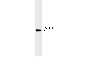 Western Blotting (WB) image for anti-Tumor Protein P53 (TP53) (AA 14-289) antibody (ABIN967419) (p53 antibody  (AA 14-289))