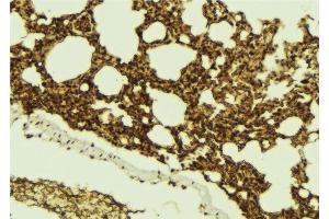 ABIN6273100 at 1/100 staining Mouse lung tissue by IHC-P.