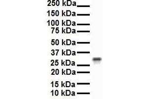 WB Suggested Anti-ECHDC2 antibody Titration: 1 ug/mL Sample Type: Human 721_B (ECHDC2 antibody  (Middle Region))