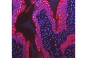 IF analysis of Cytokeratin 8/KRT8 using anti-Cytokeratin 8/KRT8 antibody (ABIN5518853). (KRT8 antibody  (AA 107-325))