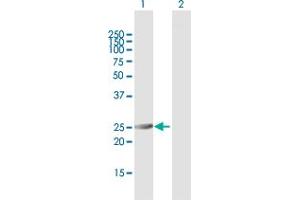 Western Blot analysis of PSMA6 expression in transfected 293T cell line by PSMA6 MaxPab polyclonal antibody. (PSMA6 antibody  (AA 1-246))