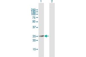 Western Blot analysis of PSMA6 expression in transfected 293T cell line by PSMA6 MaxPab polyclonal antibody. (PSMA6 antibody  (AA 1-246))