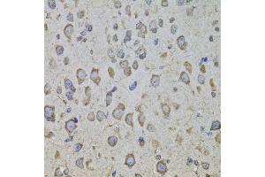 Immunohistochemistry of paraffin-embedded mouse brain using CRHR1 antibody. (CRHR1 antibody  (AA 24-120))