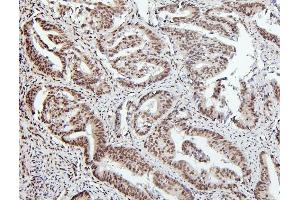 IHC analysis of PTBP1 using anti-PTBP1 antibody (ABIN7599451). (PTBP1 antibody  (AA 1-504))
