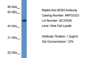 WB Suggested Anti-SOX5 Antibody Titration:  0. (SOX5 antibody  (C-Term))