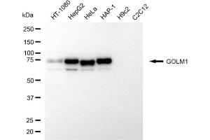 Western blotting analysis using GOLM1 antibody (ABIN7798793).