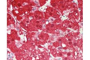 Human Adrenal: Formalin-Fixed, Paraffin-Embedded (FFPE) (AKR1B10 antibody  (AA 1-316))