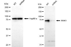anti-Interleukin-1 Receptor-Associated Kinase 1 (IRAK1) antibody
