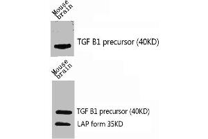 Western Blot analysis of mouse-brain using TGFβ1 Polyclonal Antibody. (TGFB1 antibody  (C-Term))