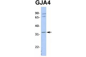 Host:  Rabbit  Target Name:  GJA4  Sample Type:  721_B  Antibody Dilution:  1. (GJA4 antibody  (Middle Region))