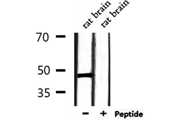 SIRPB1 antibody