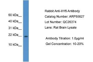 WB Suggested Anti-Il1f5  Antibody Titration: 0. (FIL1d antibody  (C-Term))
