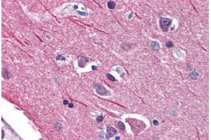 Brain, cortex (ACCN1 antibody  (AA 481-530))