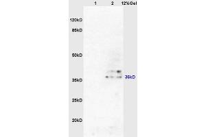 Lane 1: mouse pancreas lysates Lane 2: mouse brain lysates probed with Anti AKR1A1 Polyclonal Antibody, Unconjugated (ABIN872733) at 1:200 in 4 °C. (AKR1A1 antibody  (AA 53-130))