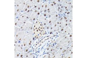 Immunohistochemistry of paraffin-embedded mouse pancreas using KPN Rabbit pAb (ABIN6131812, ABIN6142991, ABIN6142992 and ABIN6224371) at dilution of 1:100 (40x lens).