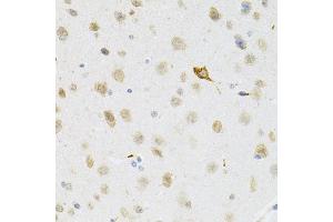 Immunohistochemistry of paraffin-embedded mouse brain using SYK Antibody (ABIN5971150) at dilution of 1/100 (40x lens). (SYK antibody)