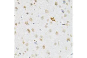 Immunohistochemistry of paraffin-embedded mouse brain using SYK Antibody (ABIN5971150) at dilution of 1/100 (40x lens). (SYK antibody)