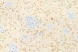 Immunohistochemistry analysis of paraffin-embedded rat brain using,KPNB1 (ABIN7074398) at dilution of 1: 1000 (KPNB1 antibody)