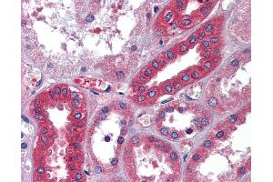 Immunohistochemistry (IHC) image for anti-Albumin (ALB) (Middle Region) antibody (ABIN2776970) (Albumin antibody  (Middle Region))