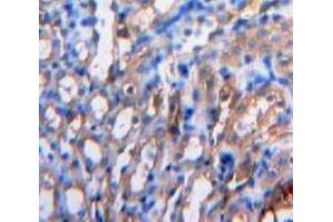 IHC-P analysis of Kidney tissue, with DAB staining. (IL-15 antibody  (AA 49-162))