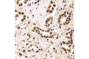 Immunohistochemistry (Paraffin-embedded Sections) (IHC (p)) image for anti-Acidic (Leucine-Rich) Nuclear phosphoprotein 32 Family, Member A (ANP32A) (AA 1-170) antibody (ABIN6136909)