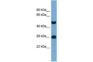 Host:  Rabbit  Target Name:  NPAS3  Sample Type:  THP-1 Whole Cell lysates  Antibody Dilution:  1. (NPAS3 antibody  (Middle Region))