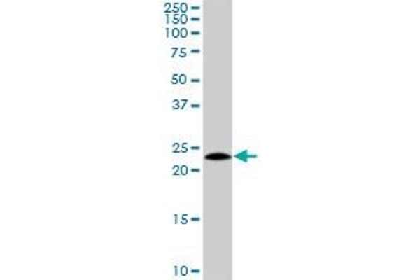 NOP16 antibody  (AA 1-178)