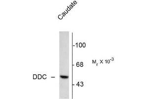 Image no. 1 for anti-Dopa Decarboxylase (Aromatic L-Amino Acid Decarboxylase) (DDC) (N-Term) antibody (ABIN372610) (DDC antibody  (N-Term))