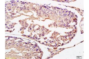 Formalin-fixed and paraffin embedded rat testis labeled with Rabbit Anti IFNAR2/IFNABR Polyclonal Antibody, Unconjugated (ABIN721825) at 1:200 followed by conjugation to the secondary antibody and DAB staining (IFNAR2 antibody  (AA 165-260))