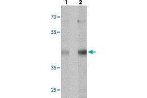 Western blot analysis of MTERFD1 in NIH/3T3 cell lysate with MTERFD1 polyclonal antibody  at (lane 1) 1 and (lane 2) 2 ug/mL. (MTERFD1 antibody  (C-Term))