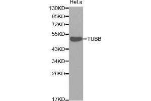 Western blot analysis of extracts of HeLa cells, using TUBB antibody (ABIN5974698).