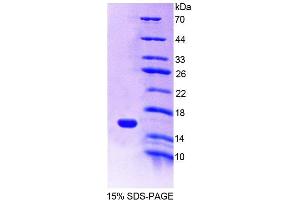 SDS-PAGE analysis of Mouse MIA1 Protein.