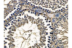 ABIN6257814 and ABIN6275282 at 1/100 staining rat testis tissue by IHC-P.