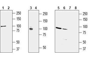 Western blot analysis of rat brain (lanes 1 and 2), mouse brain (lanes 3 and 4), human KCNQ2 transfected HEK-293 cells (lanes 5 and 7) and human brain neuroblastoma           SH-SY5Y  cell line (lanes 6 and 8) lysates: - 1,3,5,6. (KCNQ2 antibody  (C-Term, Intracellular))