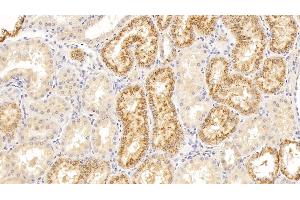 Detection of LZM in Human Kidney Tissue using Polyclonal Antibody to Lysozyme (LZM) (LYZ antibody  (AA 24-144))