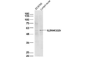 Western Blotting (WB) image for anti-Interleukin 2 Receptor, alpha (IL2RA) (AA 201-268) antibody (ABIN670371)