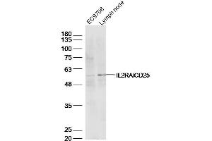 Lane 1: EC9706 lysates Lane 2: mouse lymph node lysates probed with IL2RA Polyclonal Antibody, Unconjugated  at 1:500 dilution and 4˚C overnight incubation. (CD25 antibody  (AA 201-268))