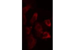 ABIN6275752 staining Hela cells by IF/ICC. (ZDHHC2 antibody)
