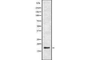 Western blot analysis of PGE synthase using Jurkat whole cell lysates (Prostaglandin E Synthase antibody  (Internal Region))
