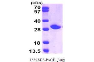 SDS-PAGE (SDS) image for Nicotinamide N-Methyltransferase (NNMT) (AA 1-264) protein (His tag) (ABIN667108)