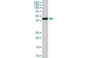 CA14 MaxPab polyclonal antibody.