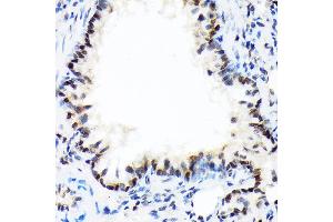 Immunohistochemistry of paraffin-embedded rat lung using DEK Rabbit mAb (ABIN7266724) at dilution of 1:100 (40x lens). (DEK antibody)