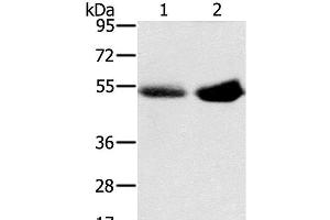 Western Blot analysis of Human placenta and plasma tissue using SLC13A3 Polyclonal Antibody at dilution of 1:200