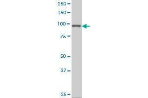 PDE4C monoclonal antibody (M03A), clone 6A10 Western Blot analysis of PDE4C expression in A-431 . (PDE4C antibody  (AA 1-99))