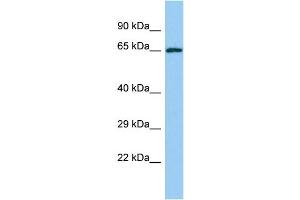 Host: Rabbit Target Name: YTHDF2 Sample Type: Jurkat Whole Cell lysates Antibody Dilution: 1.