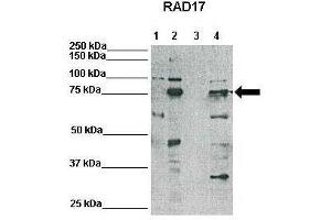 WB Suggested Anti-RAD17 Antibody    Positive Control:  Lane1: 25ug HeLa lysate, Lane2: 25ug Xenopus laevis egg extract, Lane3: 25ug mouse embryonic stem cell lysate, Lane4: 25ug HEK293T lysate   Primary Antibody Dilution :   1:500  Secondary Antibody :   Anti-rabbit-HRP   Secondry Antibody Dilution :   1:3000  Submitted by:  Domenico Maiorano, Institute of Human Genetics, CNRS (RAD17 antibody  (N-Term))